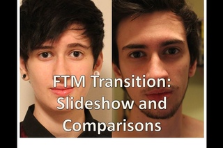 FTM transgender transition timeline: slideshow and comparisons (nearly 3 years on T)