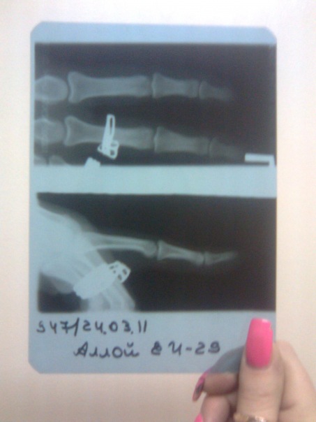 №3, Катенька Аллой, Санкт-Петербург, Россия №3, Катенька Аллой, Санкт-Петербург, Россия