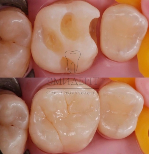 Стоматология Эмидент • Стерлитамак Строителей 28 •...